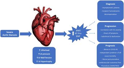 B-type natriuretic peptide and N-terminal Pro-B-type natriuretic peptide in severe aortic stenosis: a comprehensive literature review